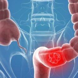 طهران تسحب أرملة سجين منتحر.. من بين ابنيها في المطار