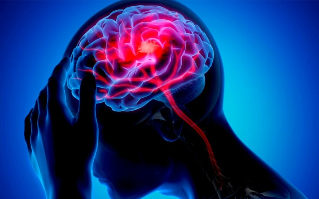 أعراض خطيرة تنذر بالسكتة الدماغية.. لا تتجاهلها