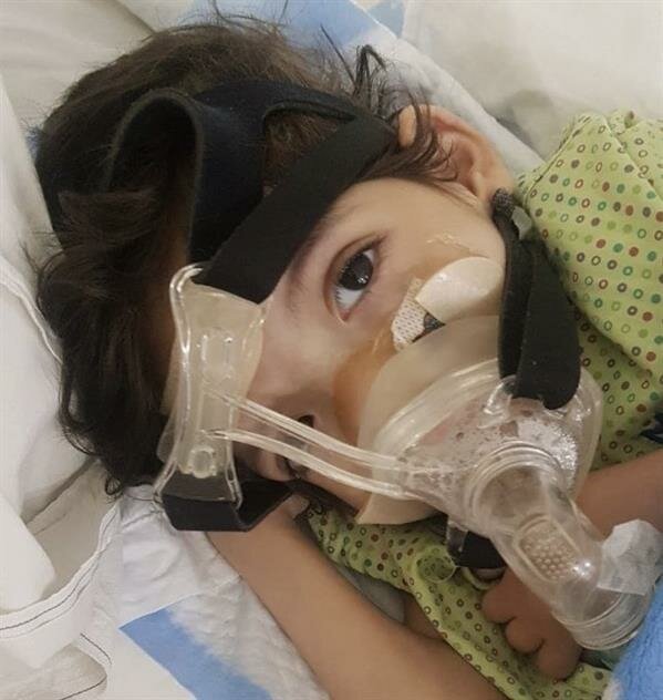 بعد توجيهات قيادة المملكة.. نجاح عملية الطفل الكويتي براك حسين