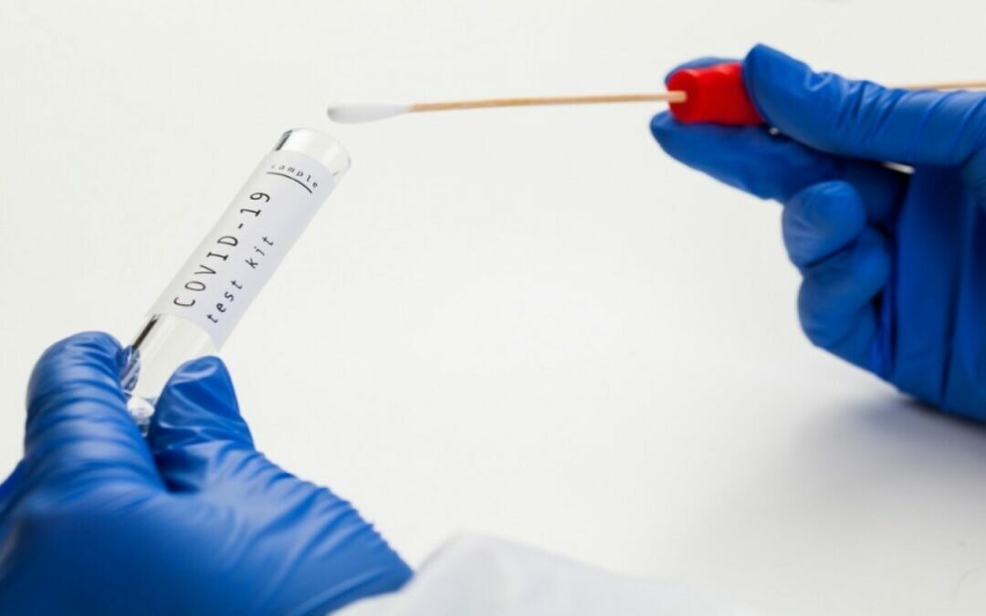 الكويت تستثني القادمين من أوكرانيا من فحص PCR