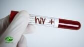 اكتشاف طبي.. تطوير دواء شامل ضد الإيدز